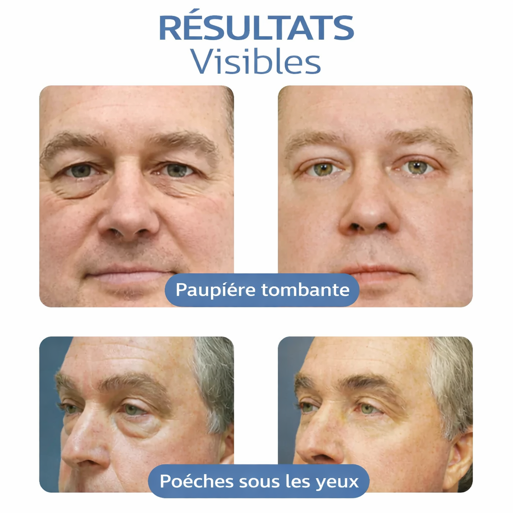 OPENEYES Gel contour des yeux liftant aux peptides Awaken