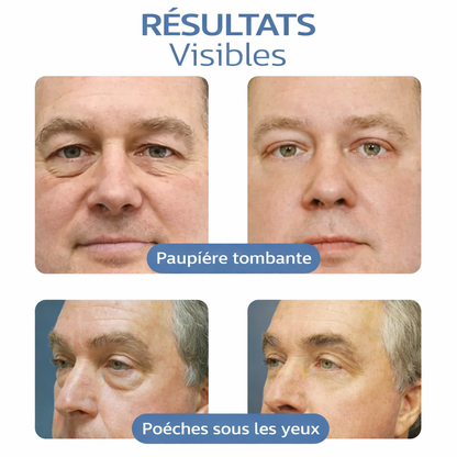 OPENEYES Gel contour des yeux liftant aux peptides Awaken